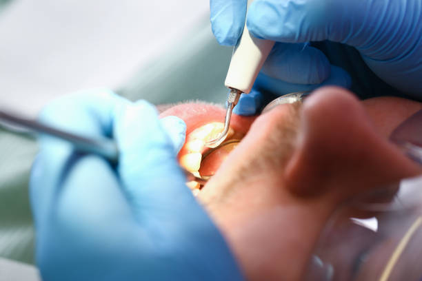 Best Emergency Denture Repair in Lowry Crossing, TX