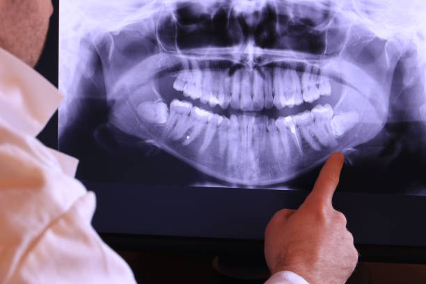 Best Weekend Emergency Dental Services in Lowry Crossing, TX