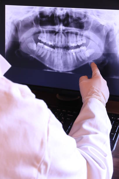 Best Emergency Wisdom Tooth Extraction in Lowry Crossing, TX